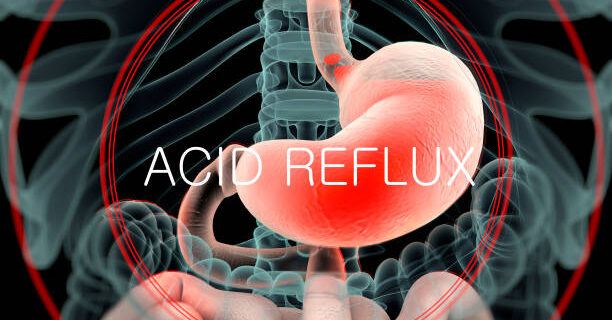 At Home Remedies For Acid Reflux